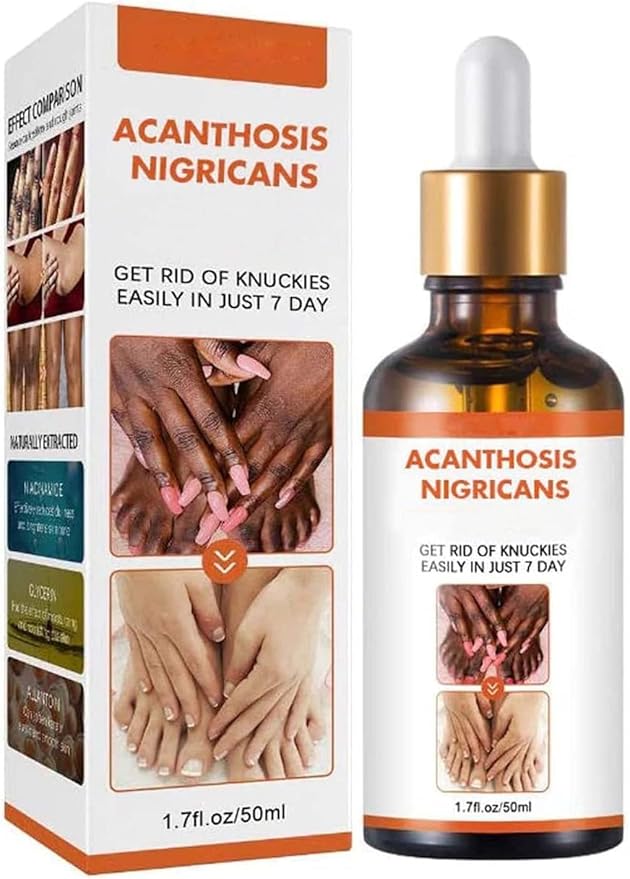 Aceite Aclarante Para Acantosis Nigricans