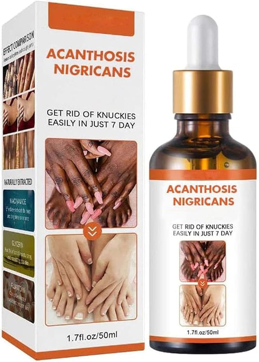 Aceite Aclarante Para Acantosis Nigricans