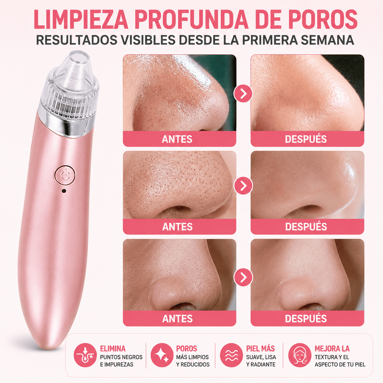 Extractor Facial de Puntos Negros