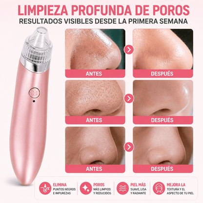 Extractor Facial de Puntos Negros
