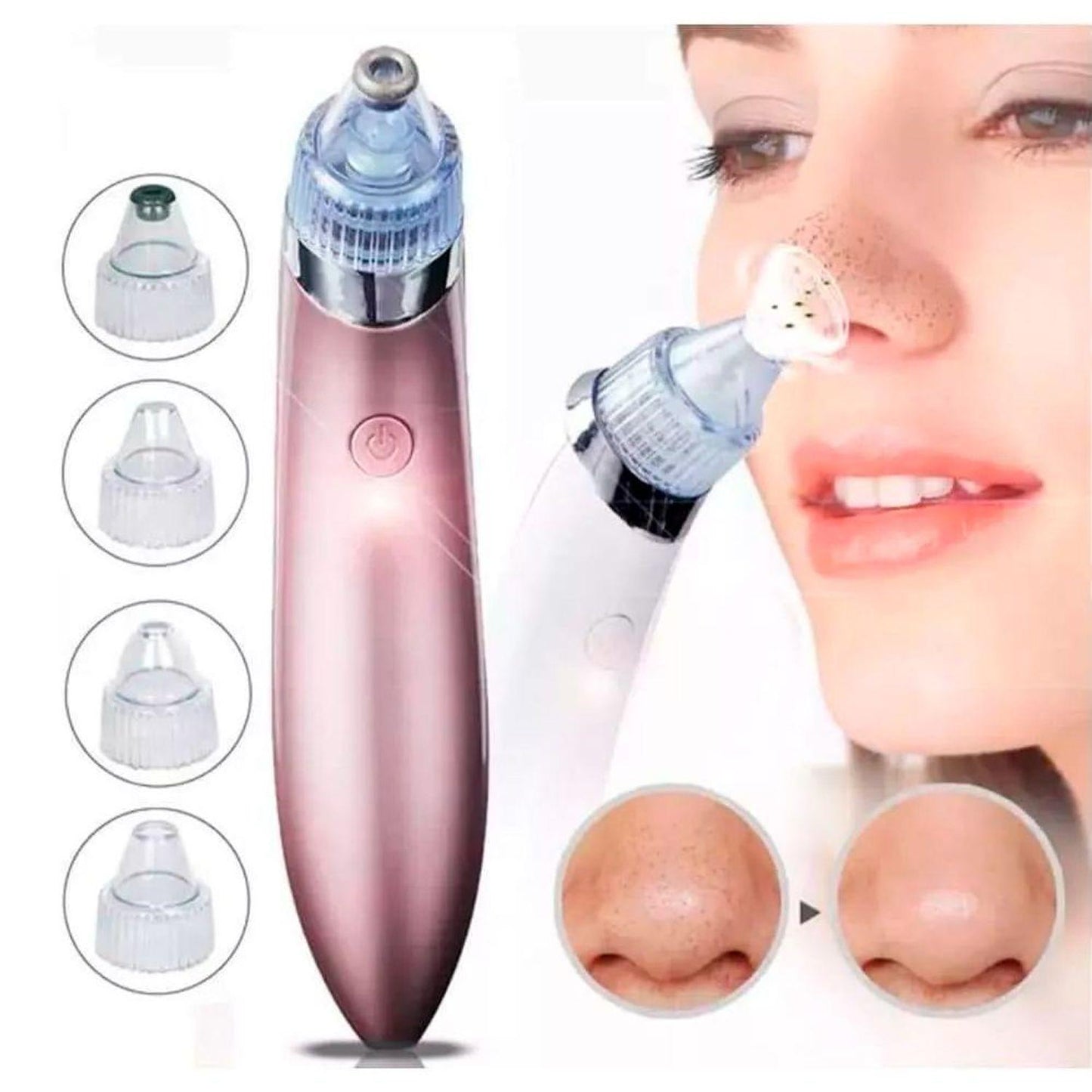 Extractor Facial de Puntos Negros
