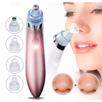 Extractor Facial de Puntos Negros